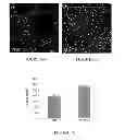 Fig. 06 - METHODS OF TREATMENT FOR RETINAL DISEASES