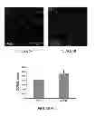 Fig. 07 - METHODS OF TREATMENT FOR RETINAL DISEASES
