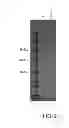 Fig. 07 - Water soluble membrane proteins and methods for the preparation and use thereof
