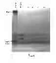 Fig. 06 - Lipid-containing PSA compositions, methods of isolation and methods of use thereof