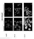 Fig. 04 - Phosphaplatin mediated modulation of pigment epithelial derived factor and uses thereof