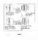 Fig. 02 - Dithiol compounds and treatment of presbyopia using said compounds