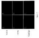 Fig. 09 - METHODS OF SCREENING COMPOUNDS THAT ARE CYTOTOXIC TO TUMOR CELLS AND METHODS OF TREATING TUMOR CELLS USING SUCH COMPOUND