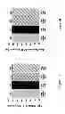 Fig. 06 - RASAGILINE FOR PARKINSON'S DISEASE MODIFICATION