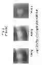 Fig. 03 - DUAL-ENERGY IMAGE SUPPRESSION METHOD