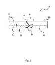 Fig. 03 - Disposable Vibratory Apparatus