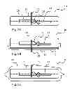 Fig. 04 - Disposable Vibratory Apparatus
