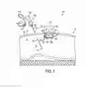 Fig. 07 - System for performing a minimally invasive surgical procedure