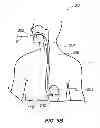 Fig. 07 - OPTICAL PROBE DELIVERY AND RETRIEVAL SYSTEMS AND METHODS