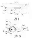 Fig. 08 - OPTICAL PROBE DELIVERY AND RETRIEVAL SYSTEMS AND METHODS