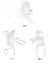 Fig. 02 - OXYGEN MASK ADAPTABLE FOR UPPER GASTROINTESTINAL (UGI) ENDOSCOPY PROCEDURES PROVIDING ENHANCED OXYGEN CONCENTRATION TO MAINTAIN PATIENT OXYGENATION
