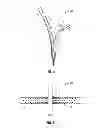 Fig. 04 - MINIMALLY INVASIVE RETRACTOR SCREW AND METHODS OF USE