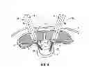 Fig. 06 - MINIMALLY INVASIVE RETRACTOR SCREW AND METHODS OF USE