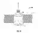 Fig. 07 - Access assembly insertion device