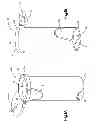 Fig. 02 - Surgical access tube