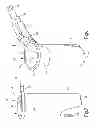 Fig. 06 - Surgical access tube
