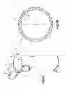 Fig. 10 - Surgical access tube