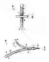 Fig. 04 - Minimally invasive retractor and methods of use