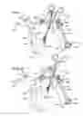 Fig. 02 - Retraction of the left atrial appendage