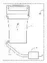 Fig. 01 - HAIR REMOVAL APPARATUS FOR PERSONAL USE AND THE METHOD OF USING SAME