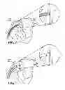 Fig. 03 - Retractable mapping jacket