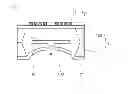 Fig. 01 - Intraocular pressure sensor and method for manufacturing same