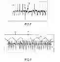 Fig. 07 - Representative emulation of organ behavior