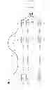 Fig. 04 - Motion-corrected pet images