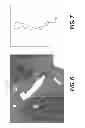 Fig. 06 - Method and system for patient-specific modeling of blood flow