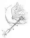Fig. 01 - TISSUE SITE MARKERS FOR IN VIVO IMAGING