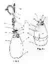 Fig. 02 - Drainage system for wounds