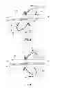 Fig. 03 - Extracorporeal pressure shock wave devices with multiple reflectors and methods for using these devices