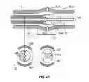 Fig. 29 - Extracorporeal pressure shock wave devices with multiple reflectors and methods for using these devices