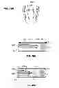 Fig. 33 - Extracorporeal pressure shock wave devices with multiple reflectors and methods for using these devices