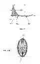 Fig. 40 - Extracorporeal pressure shock wave devices with multiple reflectors and methods for using these devices