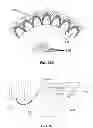 Fig. 48 - Extracorporeal pressure shock wave devices with multiple reflectors and methods for using these devices