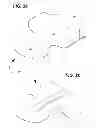 Fig. 03 - Neonatal splint