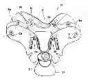 Fig. 01 - Cervical collar with cable adjustment system