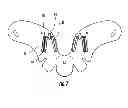 Fig. 09 - Cervical collar with cable adjustment system