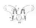 Fig. 10 - Cervical collar with cable adjustment system