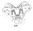 Fig. 12 - Cervical collar with cable adjustment system