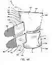 Fig. 08 - Knee brace