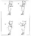Fig. 01 - Knee support