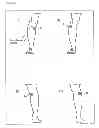 Fig. 05 - Knee support