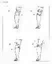 Fig. 06 - Knee support