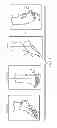 Fig. 02 - Ankle stabilization/sprain prevention in a shoe