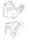 Fig. 04 - Ankle stabilization/sprain prevention in a shoe