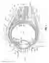 Fig. 02 - Method and apparatus for reducing intraocular pressure of an eye
