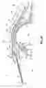 Fig. 05 - Method and apparatus for reducing intraocular pressure of an eye