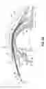 Fig. 06 - Method and apparatus for reducing intraocular pressure of an eye